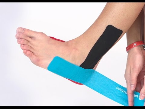발뒤꿈치 통증을 위한 키네시올로지 테이프