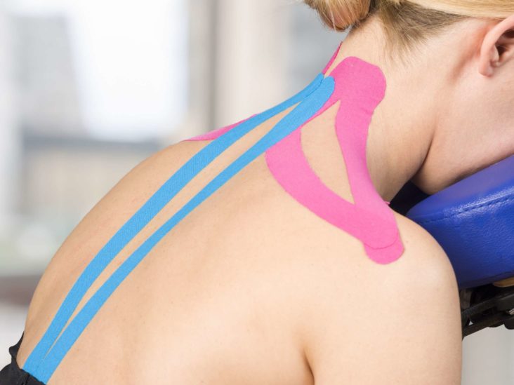 Kinesiologisches Tape für den Trapezius