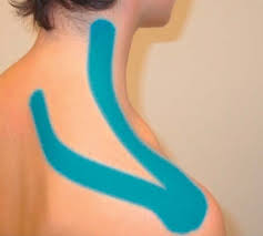 kinesiology tape for trapezius1