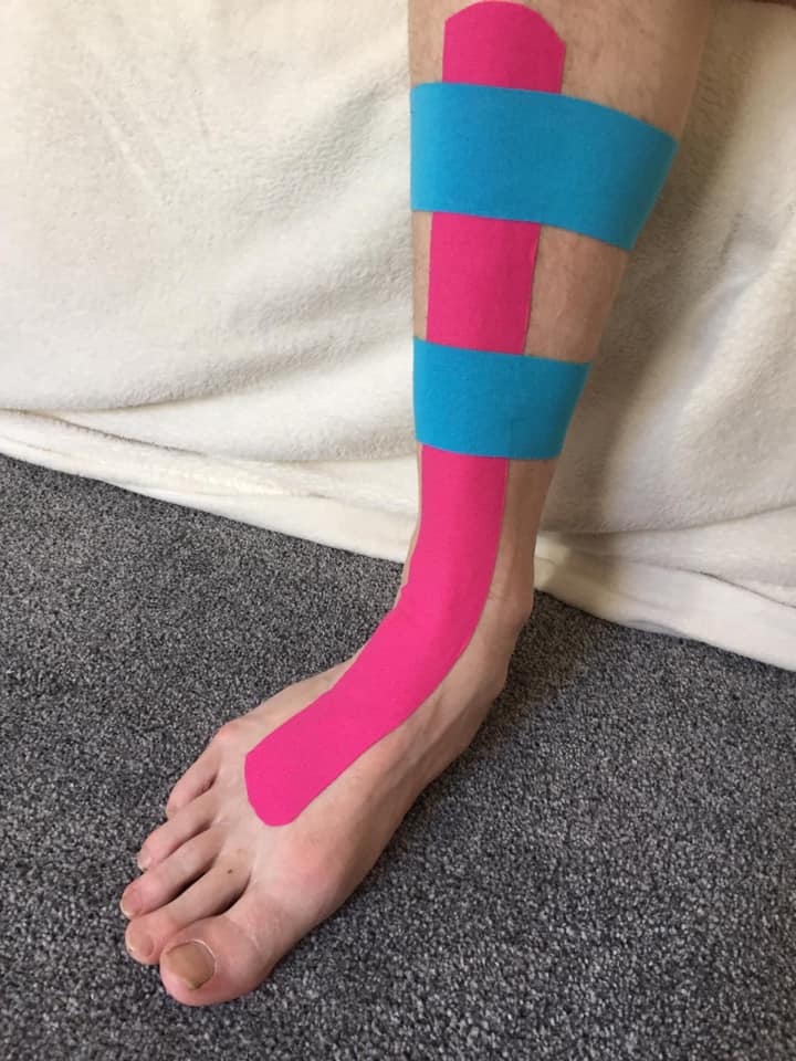 kinesiology tape for shin splints