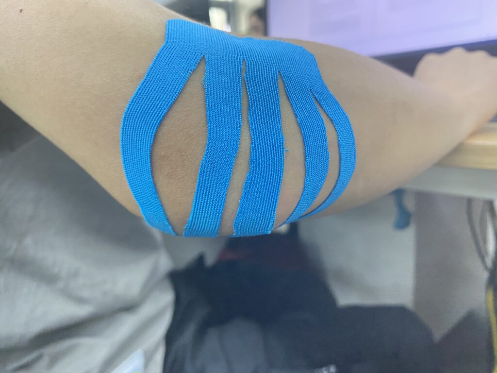 kinesiology tape for elbow treat tennis elbow-relieve pain