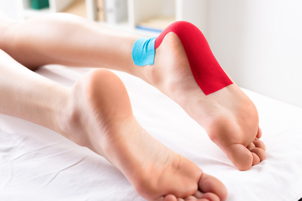 Kinesiologisches Tape bei Plantarfasziitis 