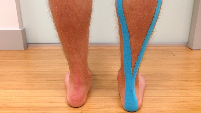Kinesiology Tape leg cramps