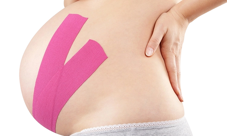 kinesiology tape pregnancy