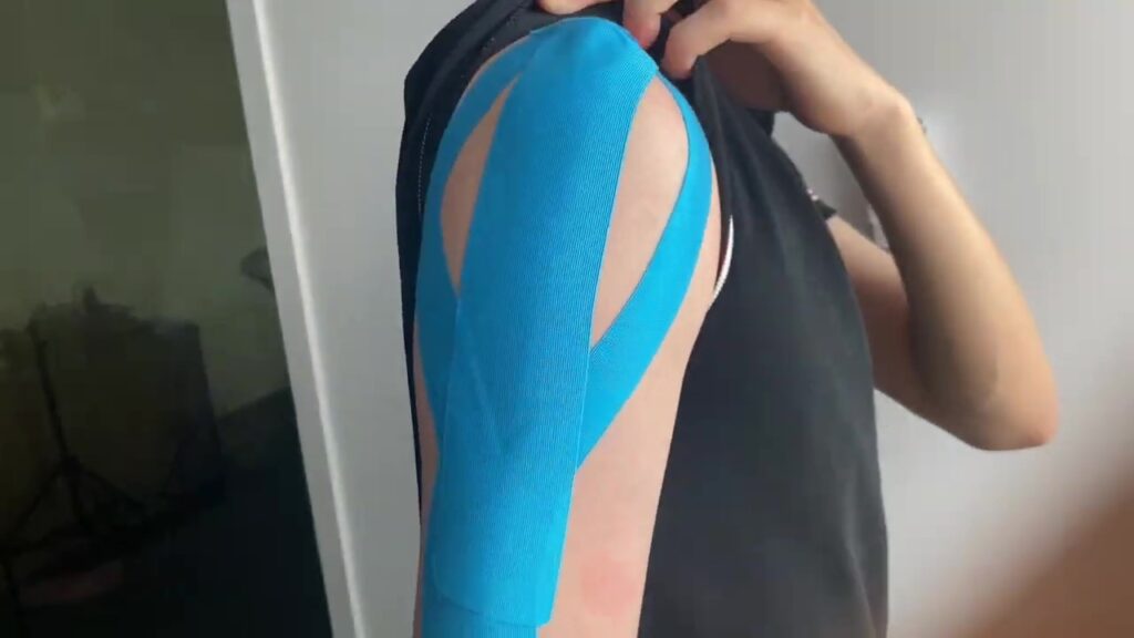 Y_shape_stickers_on_the_shoulders_is_very_효과적인_in_relieving_muscle_pain의 사용
