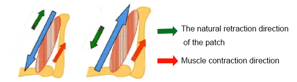 Muskelstützband