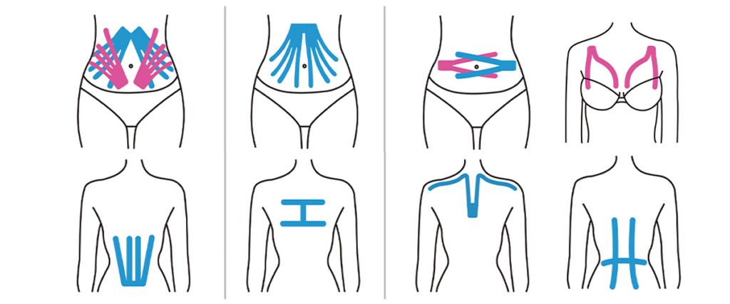 kinesiology taping application