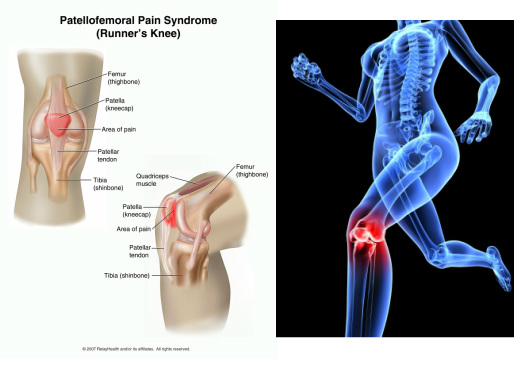 Therapeutisches Tape für das Knie