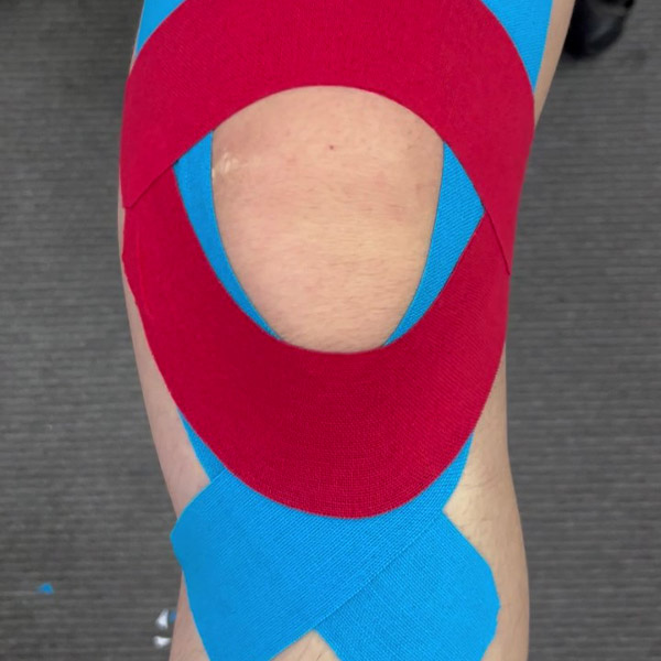 runner knee tape