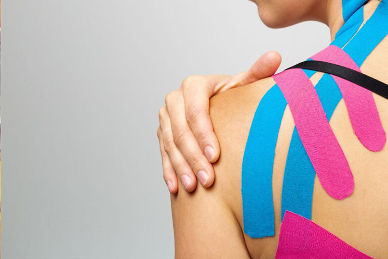 Kinesiology Tape