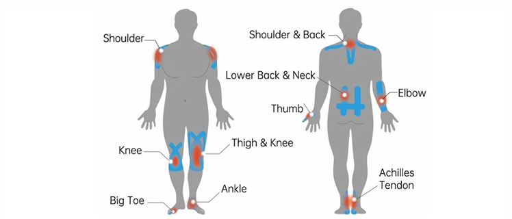 Common muscle and joint complaint