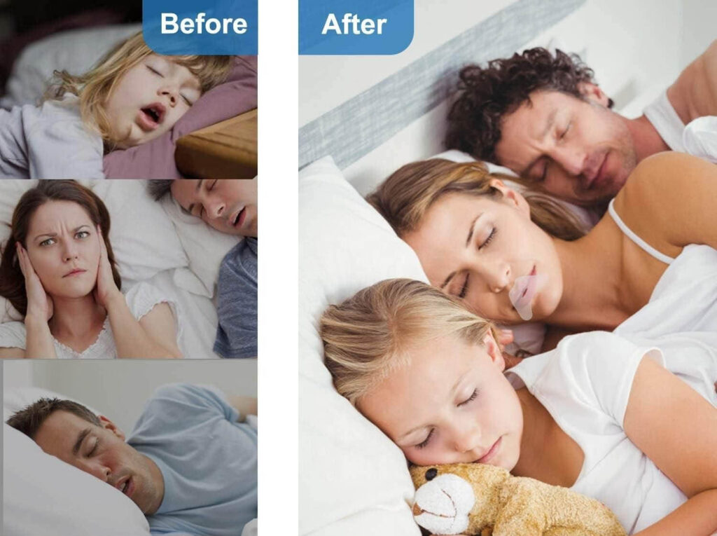 Mouth Sleep Tape Before and After